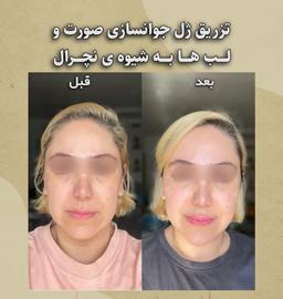 تصویر گالری آنا گودرزی 8