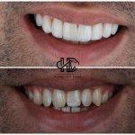 تصویر گالری مهسا دلشاد 6