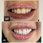 تصویر گالری سمانه فلاح 7