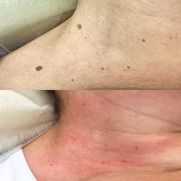 تصویر گالری ملیکا محمدزاده 14