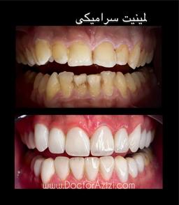 تصویر گالری عبدالکریم عزیزی 1