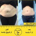 تصویر گالری شرمین صیفوری 11