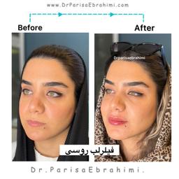 تصویر گالری پریسا ابراهیمی 1