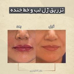 تصویر گالری آنا گودرزی 5