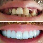 تصویر گالری رضا نظرعلی 5