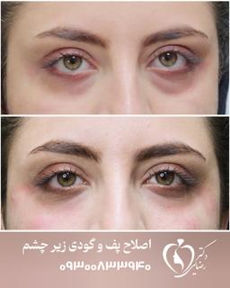 تصویر گالری محمدرضا رضایی کمال آباد 3
