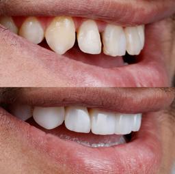 تصویر گالری نگار قلی زاده 1