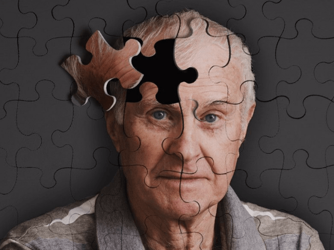 آلزایمر یا زوال عقل ؟ "پذیرش24"