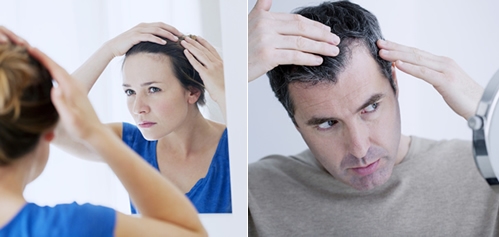 دلایل ریزش مو و درمان ها