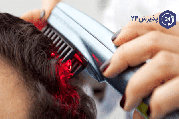 لیزر تراپی مو