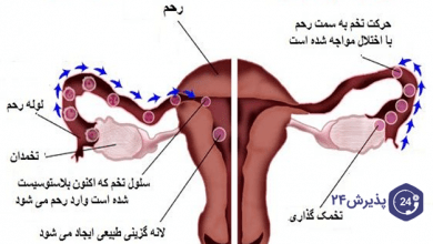 بارداری خارج از رحم