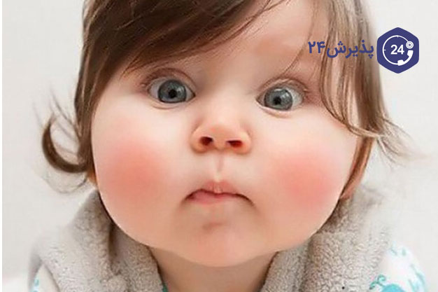 راهکارهای چاق شدن صورت