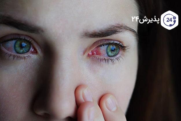 عفونت-در-چشم