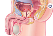 پروستات