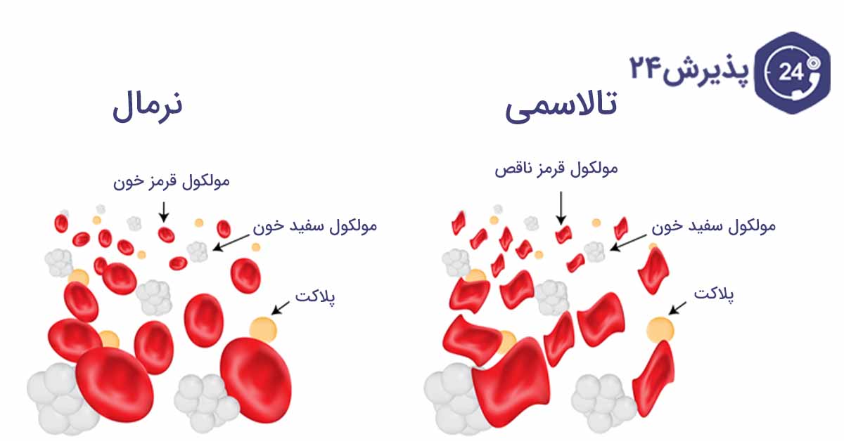 تالاسمی