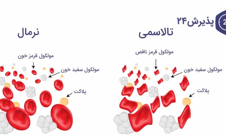 تالاسمی