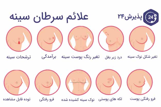 علائم سرطان سینه