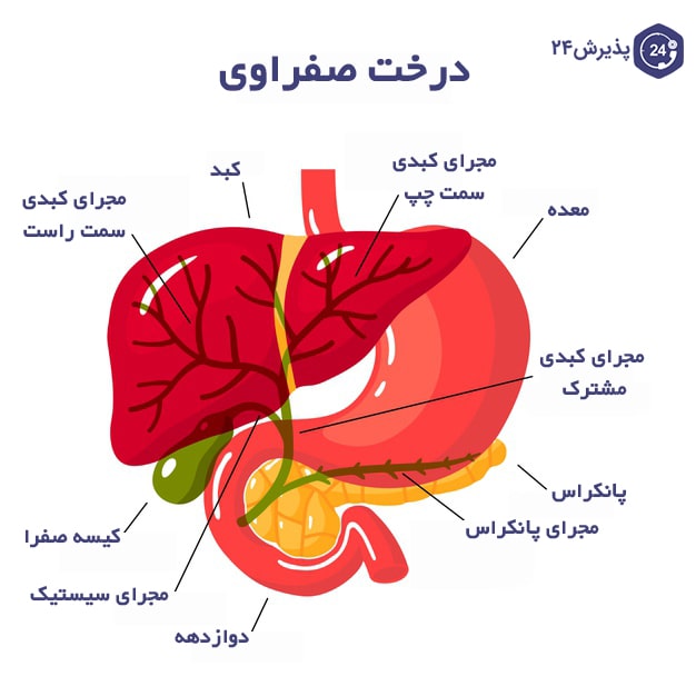 کیسه صفرا | نشانه های بروز مشکل کیسه صفرا