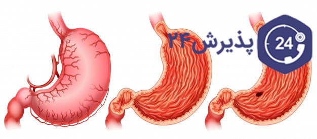 زخم اثنی عشر| :