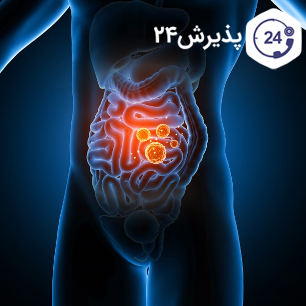 وقتی ژله یخ میزند چیکار کنیم
