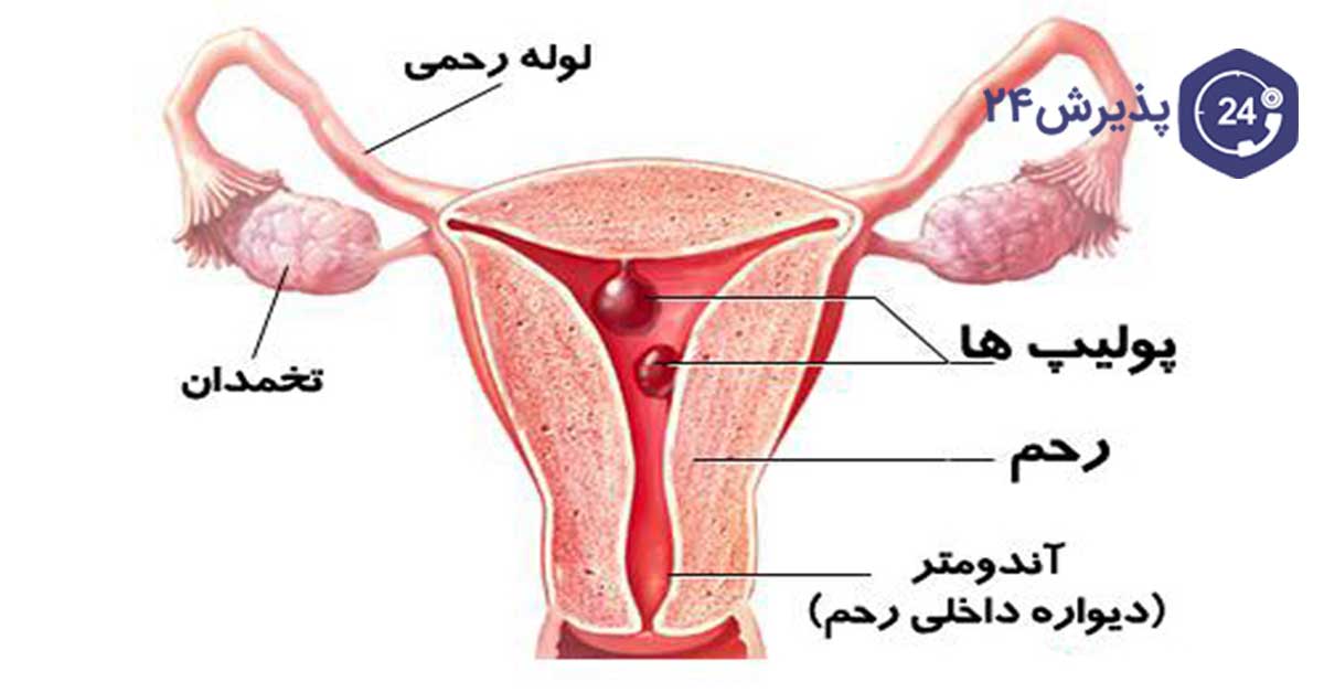 مشکلات باروری در زنان