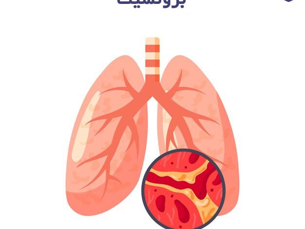 بیماری برونشیت| انواع، علائم و درمان خانگی و دارویی