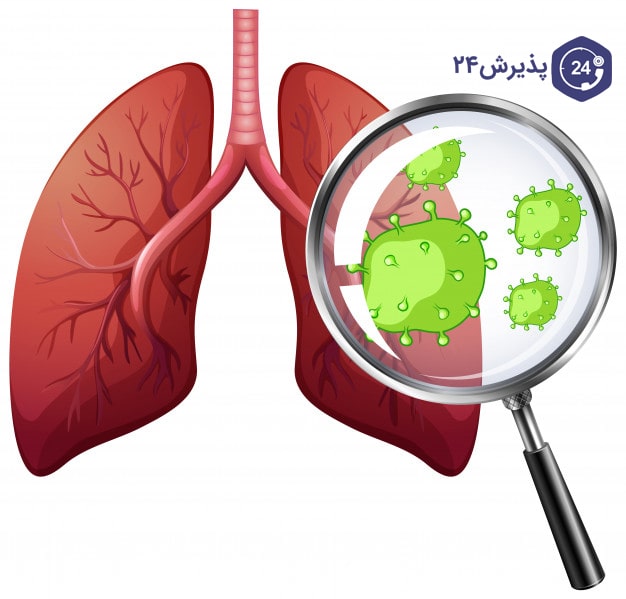 عفونت ریه| علائم، راه های درمان و پیشگیری