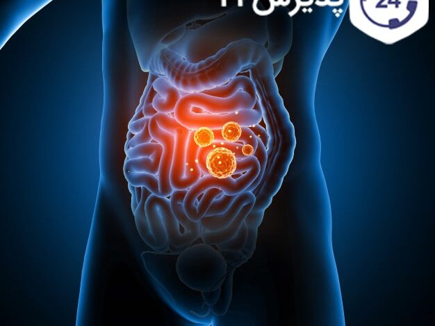 عفونت روده | علائم، راه های درمان و پیشگیری