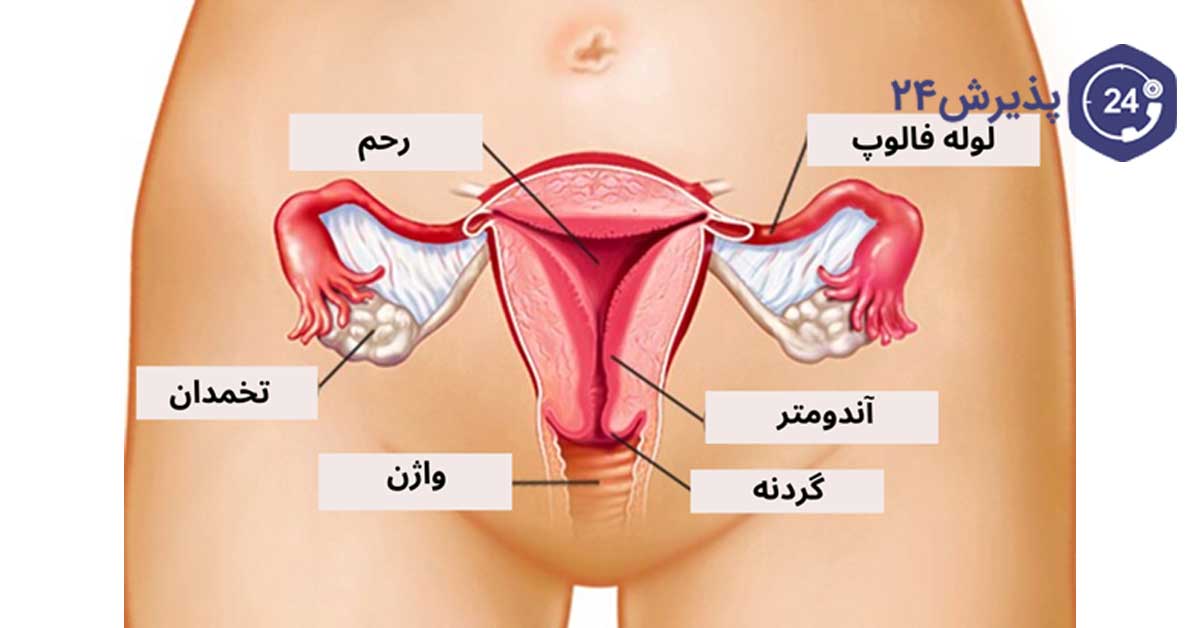 هیسترکتومی چیست