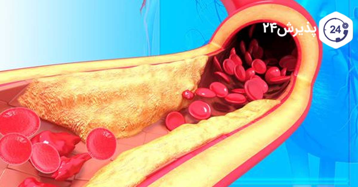 درمان کلسترول خون