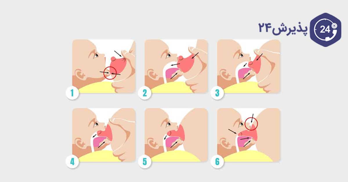 روشهای شیردهی به نوزاد