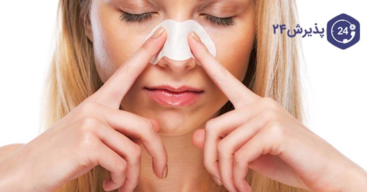 جوش روی بینی را چطور درمان کنیم
