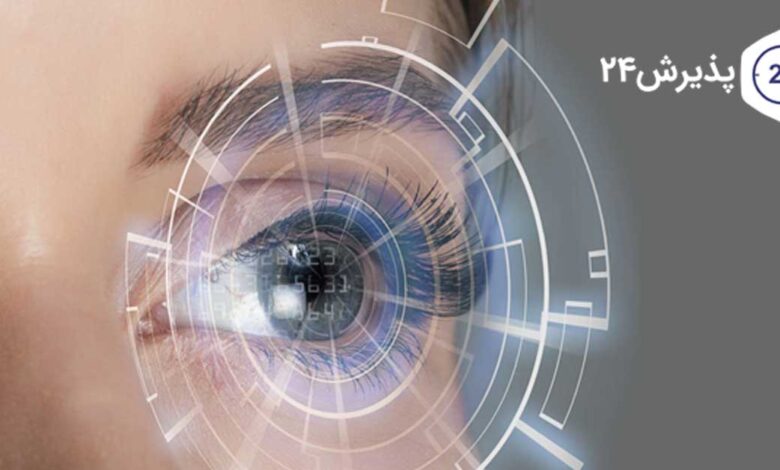 عمل لیزیک چشم