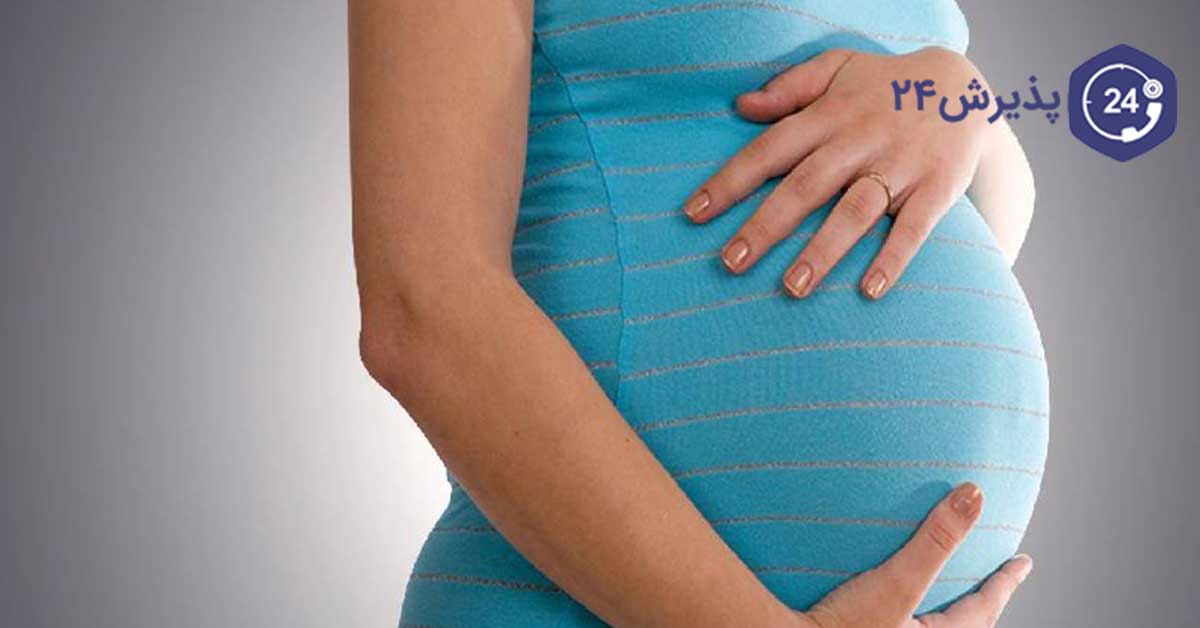 درمان ترک روی شکم در بارداری