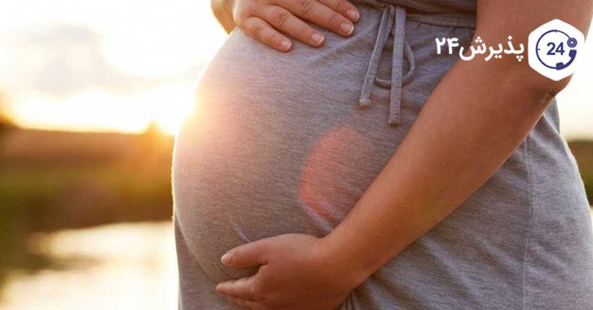 دلایل تیرکشیدن واژن در بارداری