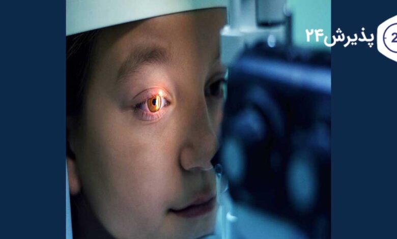 علل روماتیسم چشمی