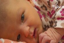 درمان زردی نوزادان با طب سنتی