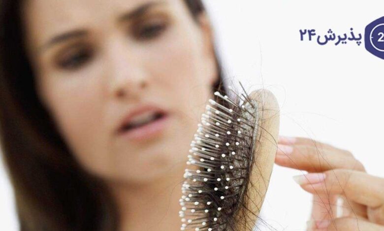 ریزش مو در شیردهی