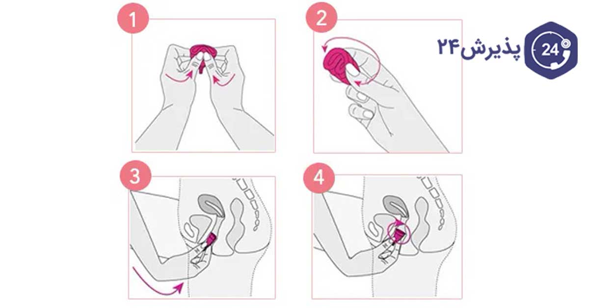 طریقه استفاده کاپ قاعدگی