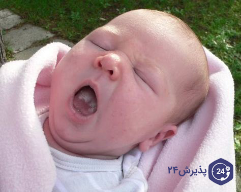 برفک دهان نوزاد