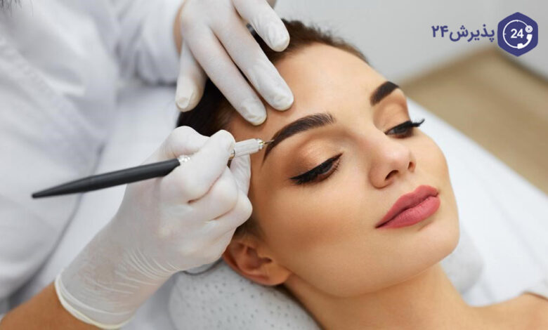 میکروپیگمنتیشن چیست