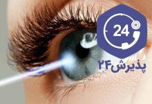ناخنک چشم