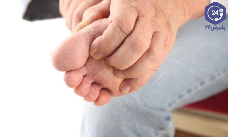 خارش کف