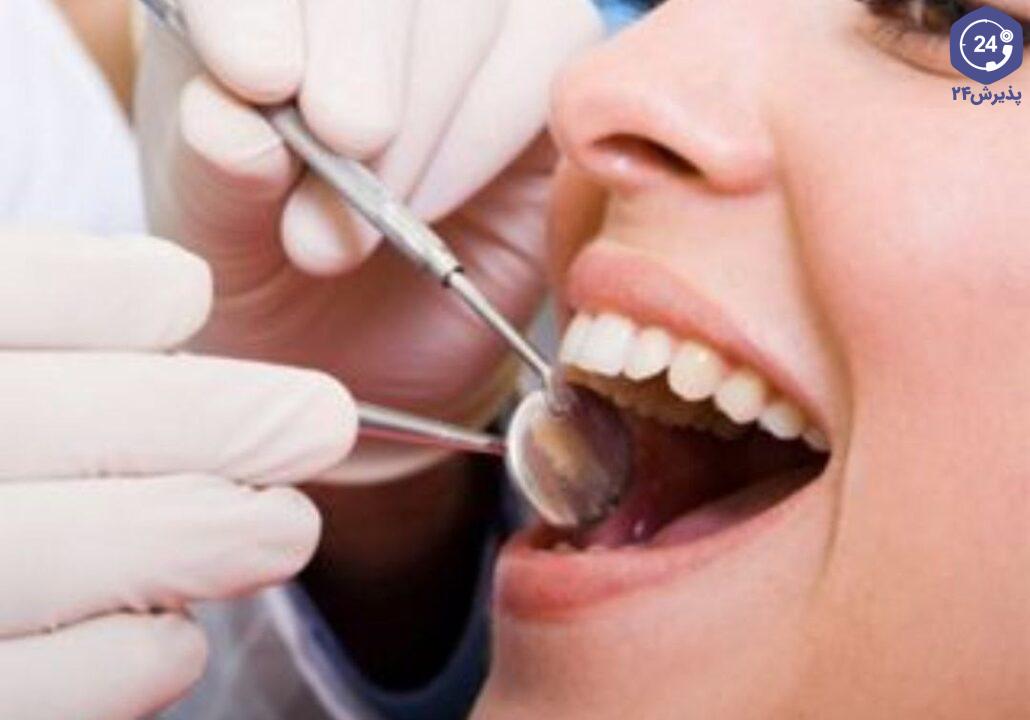تفاوت کامپوزیت و لمینت