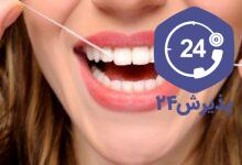 لق شدن دندان دائمی