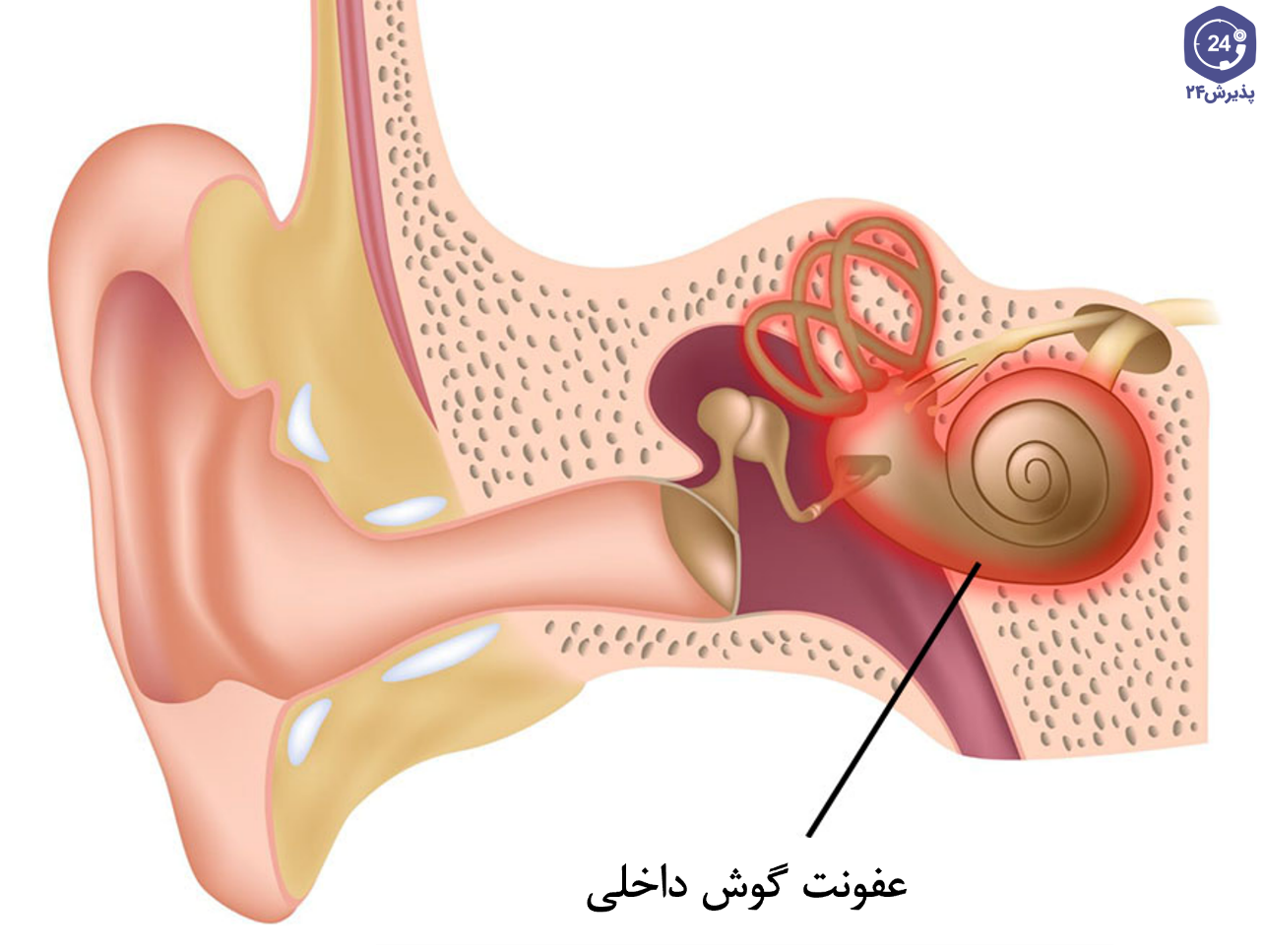 Заложенность уха тубоотит