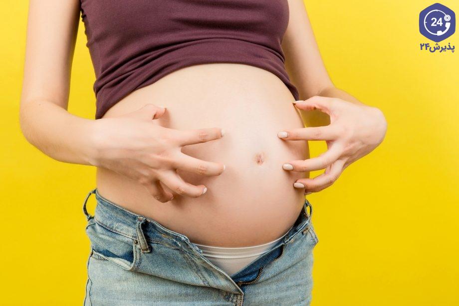 خارش بدن در بارداری
