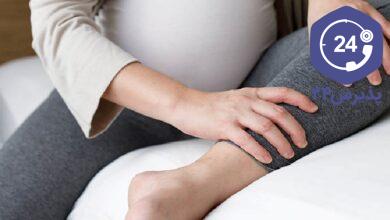 سندرم پای بیقرار در بارداری