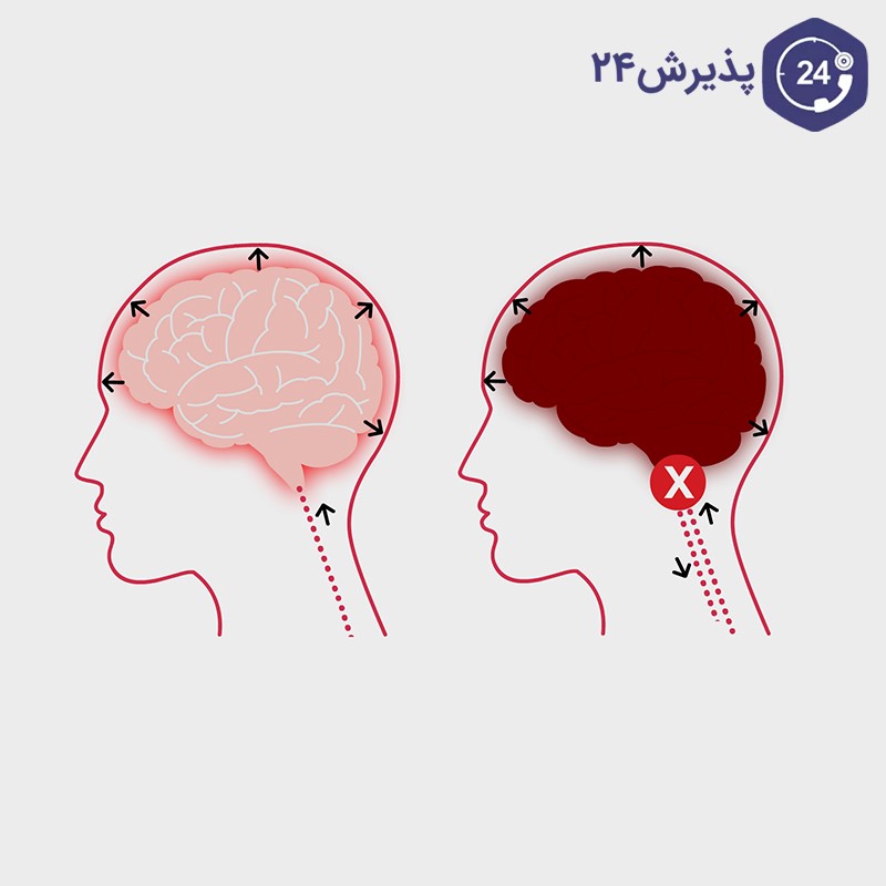 تفاوت مرگ مغزی و کما و زندگی نباتی