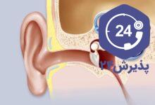 نوروم آکوستیک (تومور عصب شنوایی، acoustic neuroma)